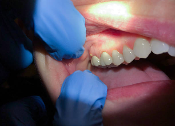 Best Walk-In Emergency Dentist in Bridgman, MI