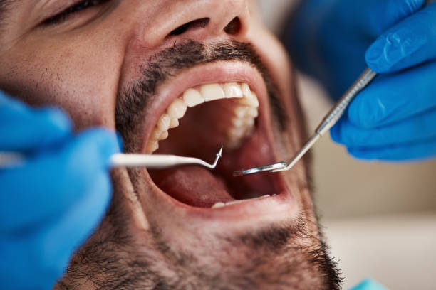 Best After-Hours Emergency Dentist in Bridgman, MI